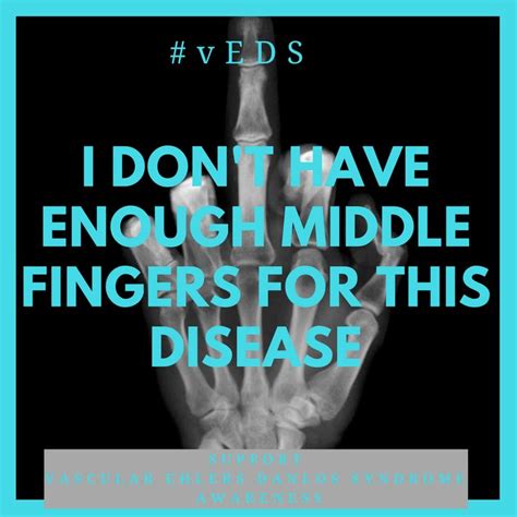 Enough Said Vascular Ehlers Danlos Syndrome Awareness Ehlers Danlos