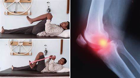 Best Knee Rheumatoid Arthritis Exercises For Stiffness Pain Physiosunit