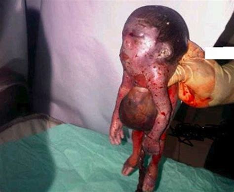 【閲覧注意】人間の女性がヤギの赤ちゃんを出産、ナイジェリア（画像） ポッカキット