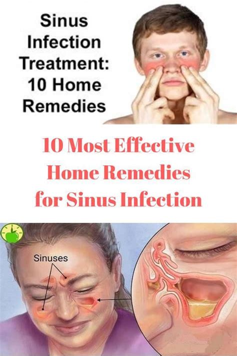 If You Suffer From Sinus Infections Then Here Are The Best Home