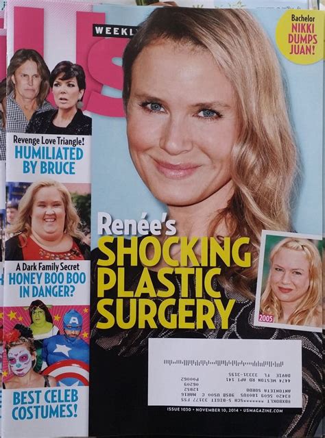 Renees Plastic Surgeryus Weekly Magazine 1030november2014