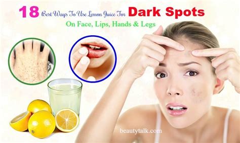 18 Uses Of Lemon Juice For Dark Spots On Face Lips Hands And Legs