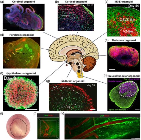Brain Organoids A Fluorescence Image Of Cerebral Organoid Scale Bar