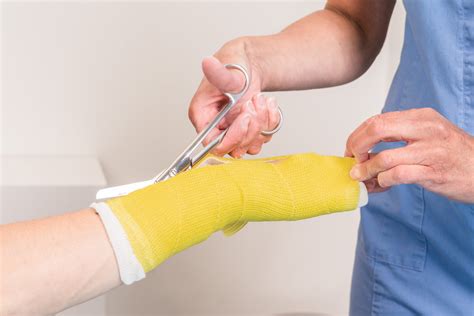 What To Expect Immediately After Cast Removal
