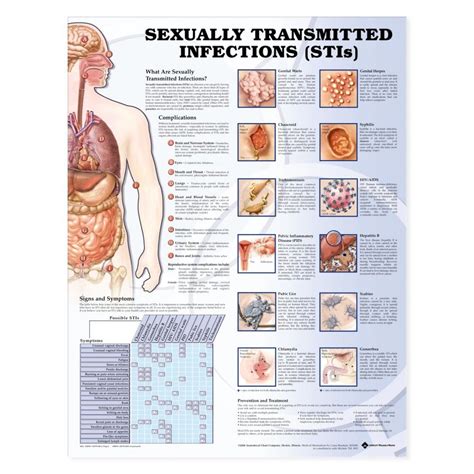 Sexually Transmitted Infections Stis Chart Poster Laminated