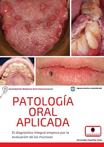 patología oral aplicada el diagnóstico integral empieza por la evaluación de las mucosas ebook