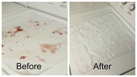 Easy Way To Remove Blood Stains Youtube