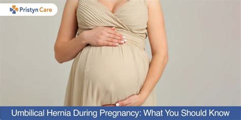 Umbilical Hernia During Pregnancy What You Should Know Pristyn Care
