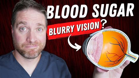 3 Ways Blood Sugar And Diabetes Can Cause Blurry Vision Youtube