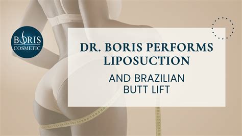 Dr Boris Performs Liposuction And Brazilian Butt Lift Boris Cosmetic