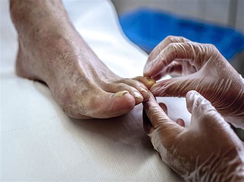 geriatric podiatrists foot care for seniors podiatry center of new jersey