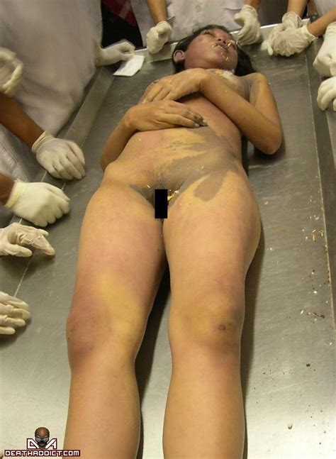 Autopsy Girl Morguemorgue Girl Naked Hot Sex Picture