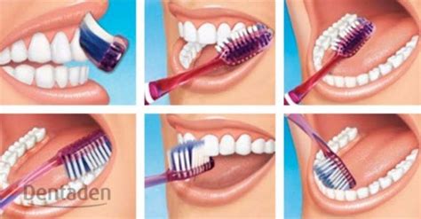 Cómo realizar un cepillado dental perfecto Dentaden