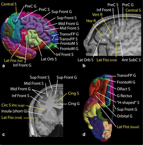 Identification Of The Sulci And Gyri Of The Frontal Lobe Lateral And
