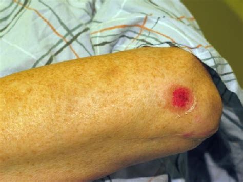It may be caused by keeping the skin under the water for a long time (bathing, swimming) or. Is Your Child Sick? - Utah Valley Pediatrics