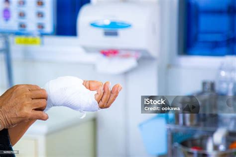Womans Hand Cover Wounds On The Hands Caused By The Surgery Causes Of