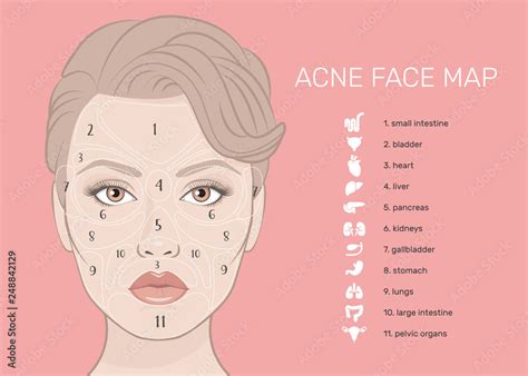 Vecteur Stock Acne Face Map Vector Illustration Of Beauty Woman Face
