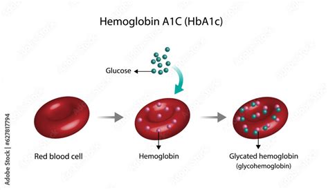 Hemoglobin A C Hba C Blood Glycated Hemoglobin Hba C Test