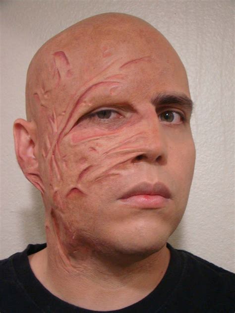 Chemical Burn Wound Moulds // Five Silicone Moulds For Bondo // SFX