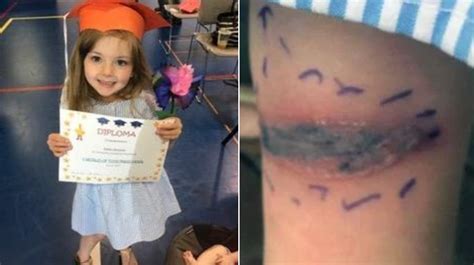 Black widow spiders get their common name from the popular belief that the female eats the male after mating, a phenomenon which rarely happens in nature. Black widow spider bite sends 5-year-old girl to emergency ...