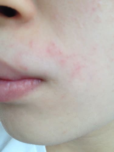 Also, keep in mind that results tend to last only a couple. Looking Glass Beauty: Do I feel Burning? NAIR hair removal ...