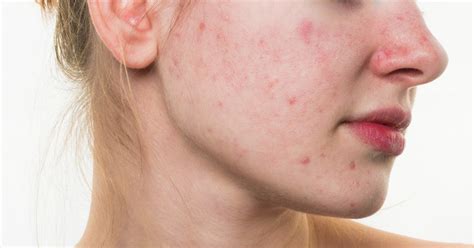 How To Treat Common Skin Problems