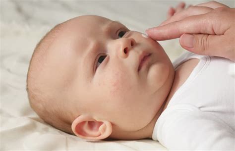 Common Skin Conditions That May Affect Your Baby