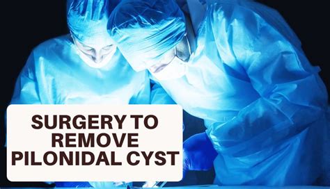 Which Is The Best Surgery To Remove Pilonidal Cyst