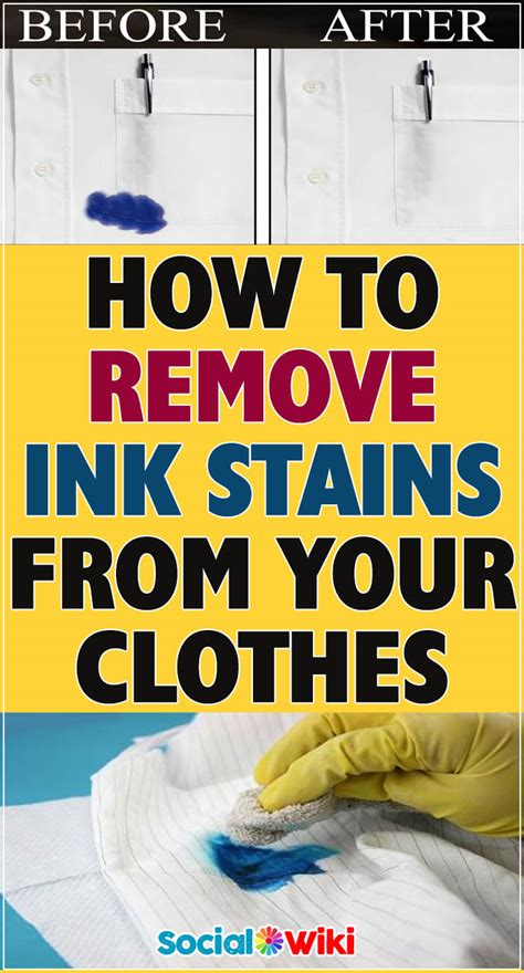 How To Remove Ink Stains From Your Clothes Social Useful Stuff