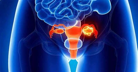 Urologic Cancer Types Stages And Treatment Tat Hit