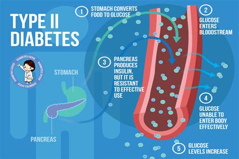 Check spelling or type a new query. Understanding the Type 2 Diabetes Causes, Signs & Symptoms ...