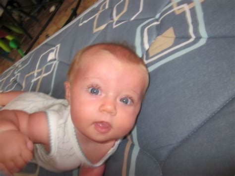 Maybe you would like to learn more about one of these? Will she outgrow a lazy eye? (pic) - Page 4 - BabyCenter