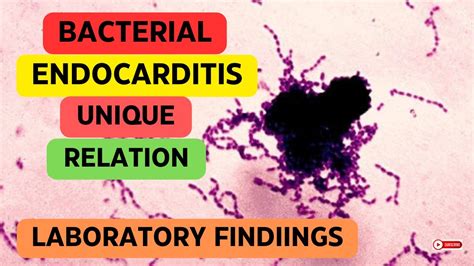 Bacterial Endocarditis Unique Relation Lab Findings Youtube