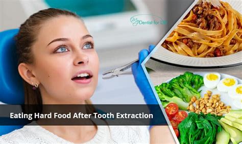When Can You Eat Solids After Tooth Extraction