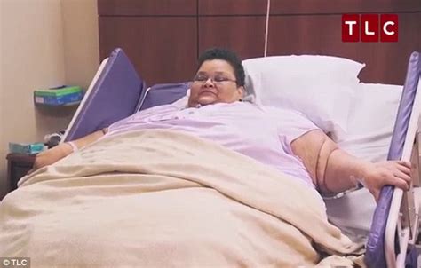 Morbidly Obese Lb Woman Has Massive Fatty Lump Weighing Lbs Removed From Her Leg So She Can