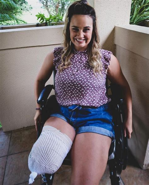 The Smile When You Finally Have Your Leg Amputation After Wanting To Be One Legged Your Whole