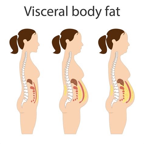 Visceral Fat And Subcutaneous Fat Accumulate Around Organs Medicine And Health Diagram About