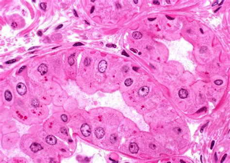 Sebaceous Gland Stock Image P7110007 Science Photo Library