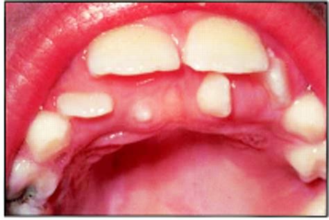 Oral Health And Disease The Bmj