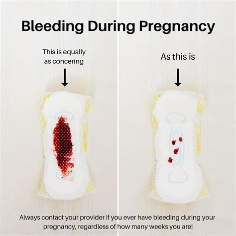 When Bleeding During Pregnancy Dobrilo