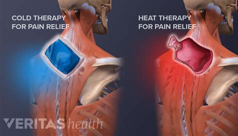 Treating Intercostal Muscle Strain Spine Health