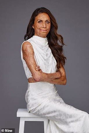 Inside Turia Pitt And Beck Zemek S Celebrity Apprentice Feud Daily Mail Online