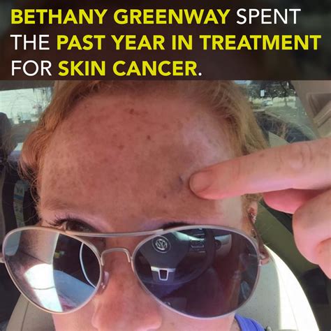 These Photos Show What A Year With Skin Cancer Looks Like