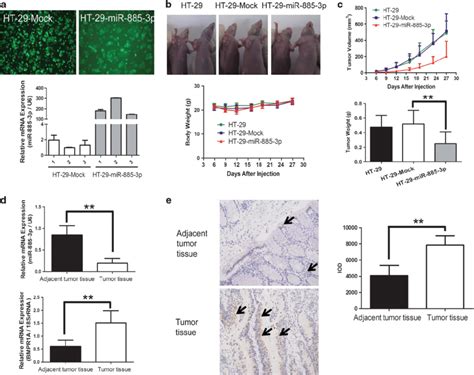 MiR 885 3p Suppresses The Growth Of HT 29 Colon Cancer Cell Xenografts