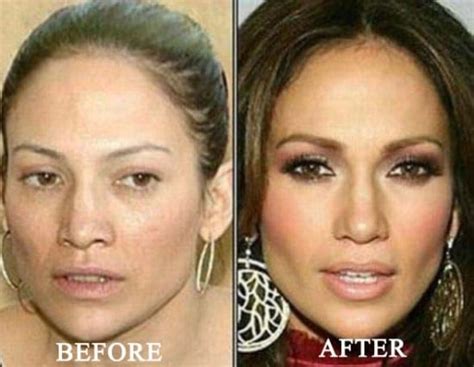 Jennifer Lopez Nose Job Photo Before And After Celeb Surgerycom