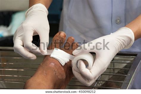 Dressing Patients Foot Bandage Stock Photo Edit Now 450098212