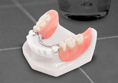 Partial Dentures Dentista Clinic