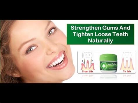 They in turn help to fight with the infections caused by harmful bacteria by boosting your immune system. How To Tighten A Loose Tooth At Home In A Few Weeks? - YouTube
