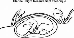 Uterine Height Measurement Technique Download Scientific Diagram