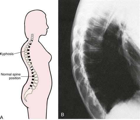 Diseases And Conditions Of The Musculoskeletal System Basicmedical Key